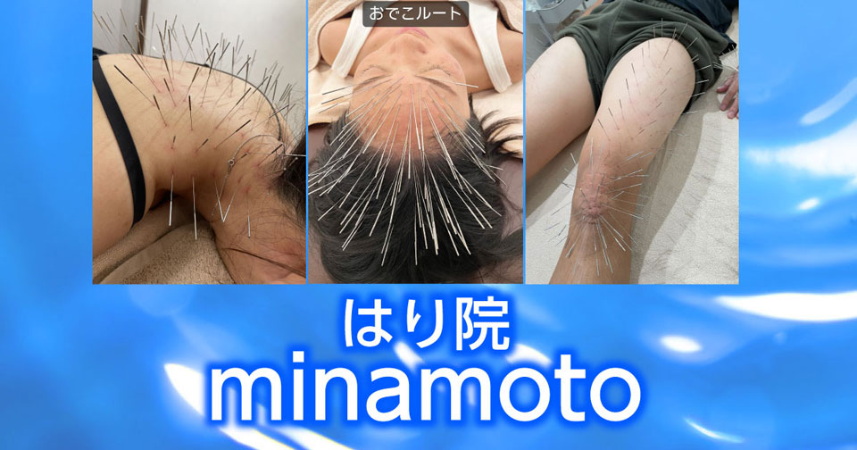 はり院 minamoto